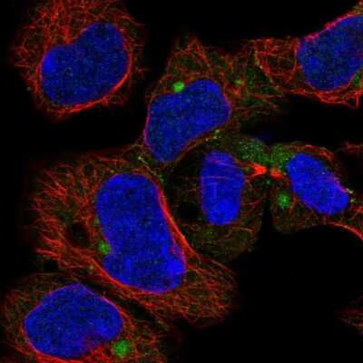 Immunocytochemistry/ Immunofluorescence: CHCHD7 Antibody [NBP2-14477]