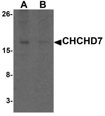 Western Blot: CHCHD7 AntibodyBSA Free [NBP2-81709]