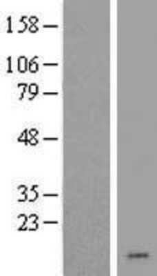 Western Blot: CHCHD7 Overexpression Lysate [NBL1-09145]