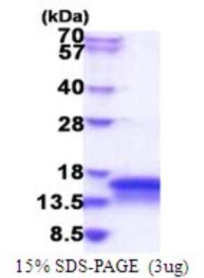 SDS-PAGE: Recombinant Human CHCHD7 His Protein [NBP2-51826]