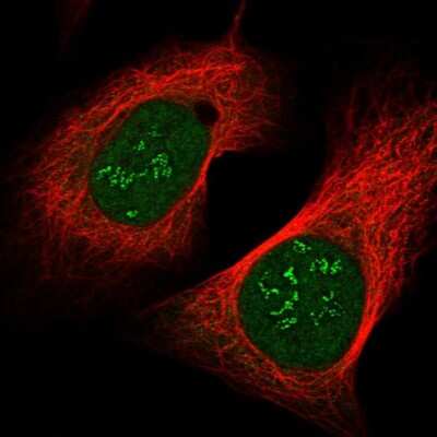 Immunocytochemistry/ Immunofluorescence: CHCHD8 Antibody [NBP1-90483]