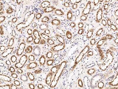 Immunohistochemistry-Paraffin: CHD1 Antibody [NBP2-98902]