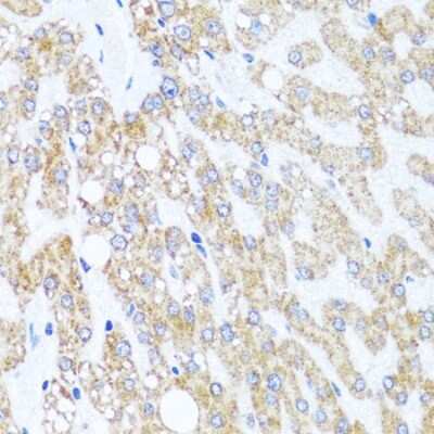 Immunohistochemistry-Paraffin: CHD1 Antibody - BSA Free [NBP3-02966]