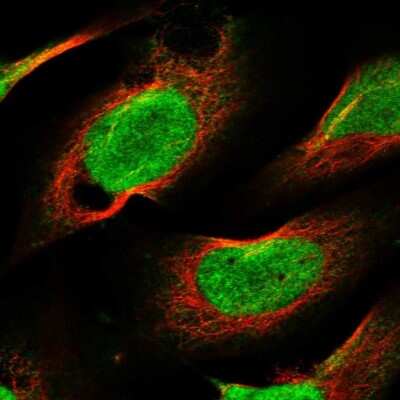 Immunocytochemistry/ Immunofluorescence: CHD1L Antibody [NBP1-89153]