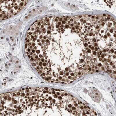 Immunohistochemistry-Paraffin: CHD1L Antibody [NBP1-89153]