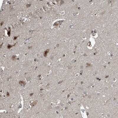 Immunohistochemistry-Paraffin: CHD1L Antibody [NBP1-89154]