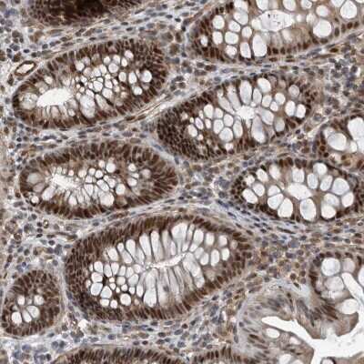 Immunohistochemistry-Paraffin: CHD1L Antibody [NBP1-89154]