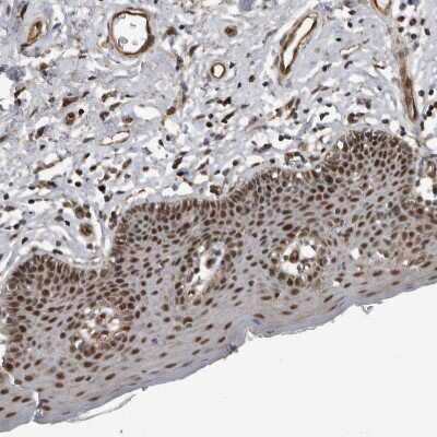 Immunohistochemistry-Paraffin: CHD1L Antibody [NBP1-89154]