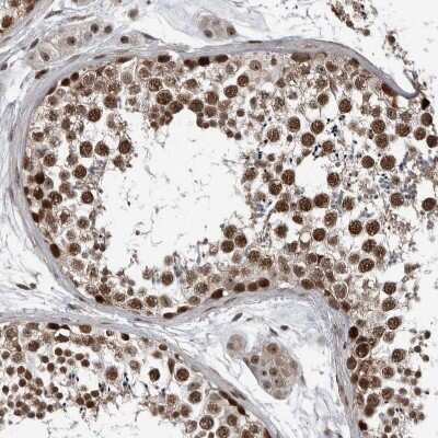 Immunohistochemistry-Paraffin: CHD1L Antibody [NBP1-89154]