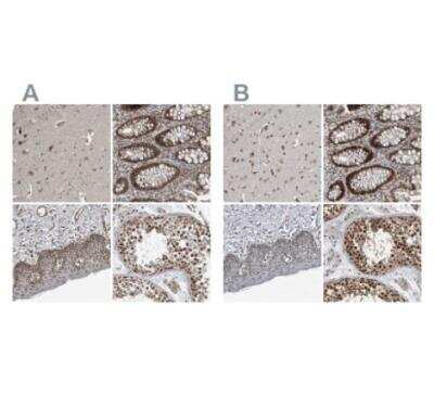 Immunohistochemistry-Paraffin: CHD1L Antibody [NBP1-89154]