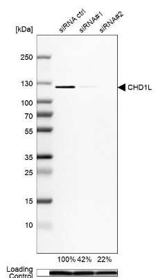 Western Blot: 0 [NBP1-89154]