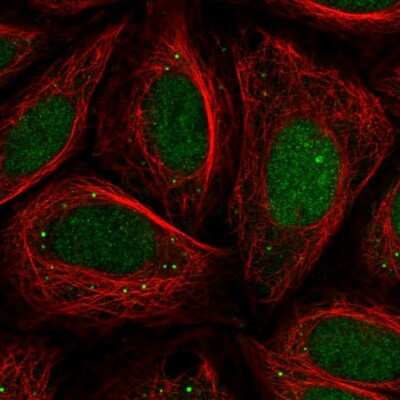 Immunocytochemistry/ Immunofluorescence: CHD2 Antibody [NBP2-32563]