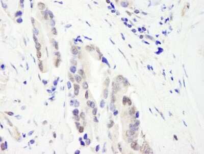 Immunohistochemistry-Paraffin: CHD3 Antibody [NB100-60412]