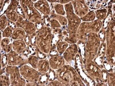 Immunohistochemistry-Paraffin: CHD3 Antibody [NBP3-13040]
