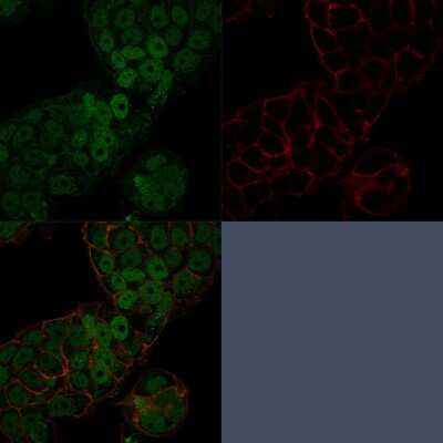 Immunocytochemistry/ Immunofluorescence: CHD4 Antibody (3F2/4) - Azide and BSA Free [NBP3-08830]