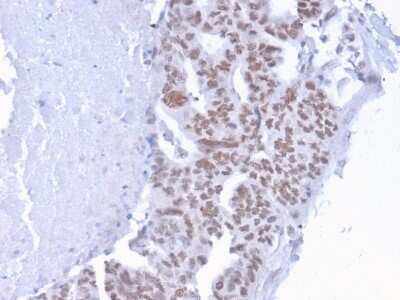 Immunohistochemistry-Paraffin: CHD4 Antibody (3F2/4) - Azide and BSA Free [NBP3-08830]