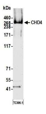 Western Blot: CHD4 Antibody (BLR066G) [NBP2-77358]