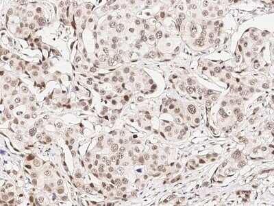 Immunohistochemistry-Paraffin: CHD4 Antibody [NBP2-99098]