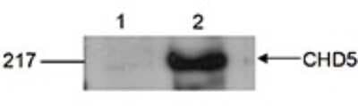 Western Blot: CHD5 Antibody [NBP3-18636]
