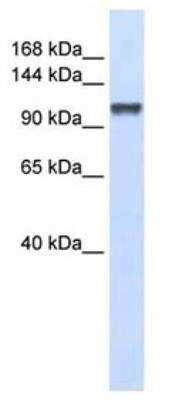 Western Blot: CHERP Antibody [NBP3-12209]