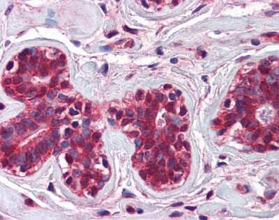 Immunohistochemistry-Paraffin: CHFR Antibody [NBP1-52955]