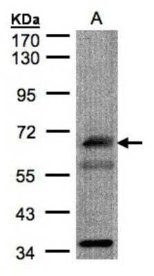 Western Blot: CHFR Antibody [NBP1-30986]