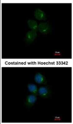 Immunocytochemistry/ Immunofluorescence: AMCase/CHIA Antibody [NBP2-15880]