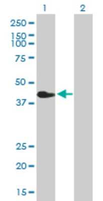 Western Blot: AMCase/CHIA Antibody [H00027159-B01P]