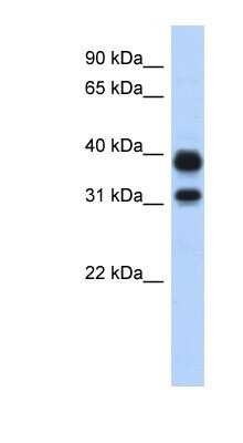 Western Blot: AMCase/CHIA Antibody [NBP1-58987]