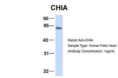 Western Blot: AMCase/CHIA Antibody [NBP1-58987]