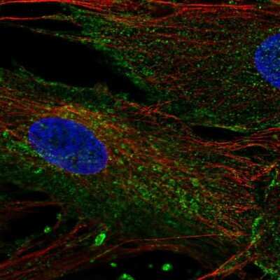 Immunocytochemistry/ Immunofluorescence: CHIC2 Antibody [NBP2-68599]