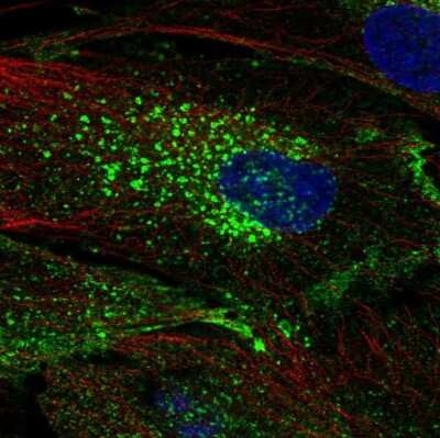 Immunocytochemistry/ Immunofluorescence: CHIC2 Antibody [NBP2-69022]