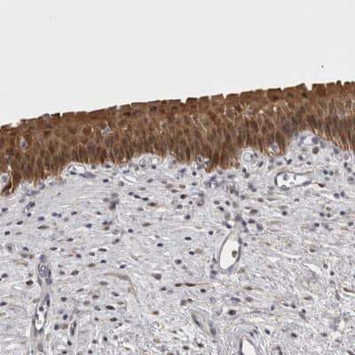 Immunohistochemistry: CHIC2 Antibody [NBP1-88513]