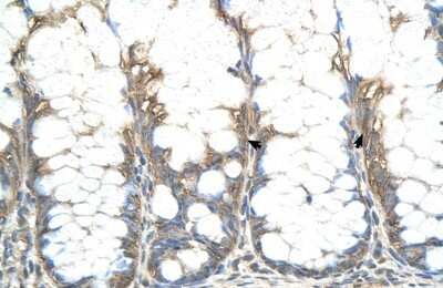 Immunohistochemistry-Paraffin: CHIC2 Antibody [NBP1-59955]