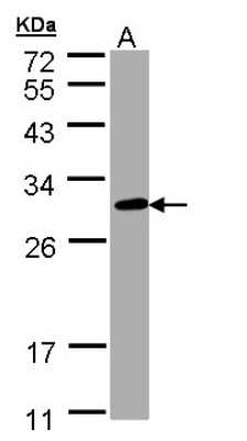 Western Blot: CHIC2 Antibody [NBP1-32719]