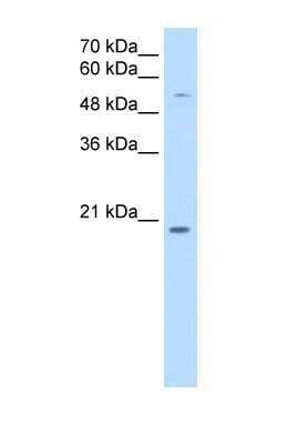 Western Blot: CHIC2 Antibody [NBP1-59955]