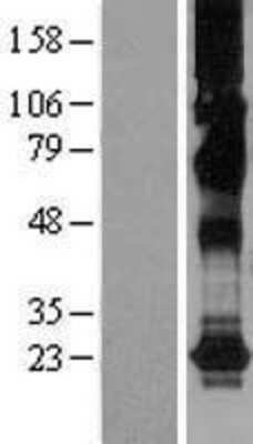 Western Blot: CHIC2 Overexpression Lysate [NBL1-09154]