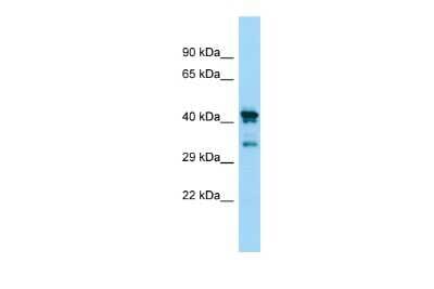 Western Blot: CHID1 Antibody [NBP2-82674]