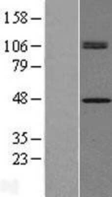 Western Blot: CHID1 Overexpression Lysate [NBL1-09155]