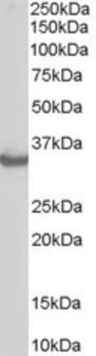 Western Blot: CHIP/STUB1 Antibody [NB300-982]