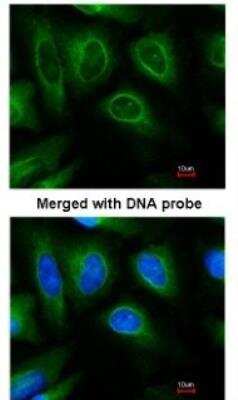 Immunocytochemistry/ Immunofluorescence: CHIP/STUB1 Antibody [NBP1-30936]