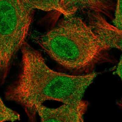 Immunocytochemistry/ Immunofluorescence: CHIP/STUB1 Antibody [NBP2-47509]