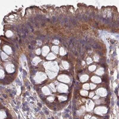 Immunohistochemistry-Paraffin: CHIP/STUB1 Antibody [NBP2-47509]