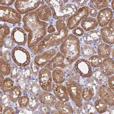 Immunohistochemistry-Paraffin: CHIP/STUB1 Antibody [NBP2-47510]