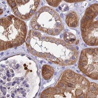 Immunohistochemistry-Paraffin: CHIP/STUB1 Antibody [NBP2-47510]