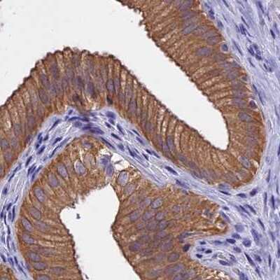 Immunohistochemistry-Paraffin: CHIP/STUB1 Antibody [NBP2-47510]