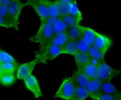 Immunocytochemistry/ Immunofluorescence: CHIP/STUB1 Antibody (JG38-22) [NBP2-75440]
