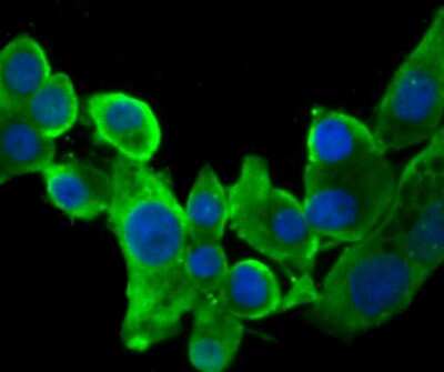 Immunocytochemistry/ Immunofluorescence: CHIP/STUB1 Antibody (JG38-22) [NBP2-75440]