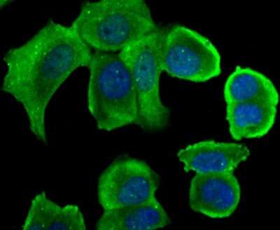 Immunocytochemistry/ Immunofluorescence: CHIP/STUB1 Antibody (JG38-22) [NBP2-75440]