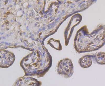 Immunohistochemistry-Paraffin: CHIP/STUB1 Antibody (JG38-22) [NBP2-75440]